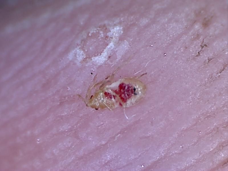 Pictures and video of bed bug nymph Â« Got Bed Bugs? Bedbugger Forums